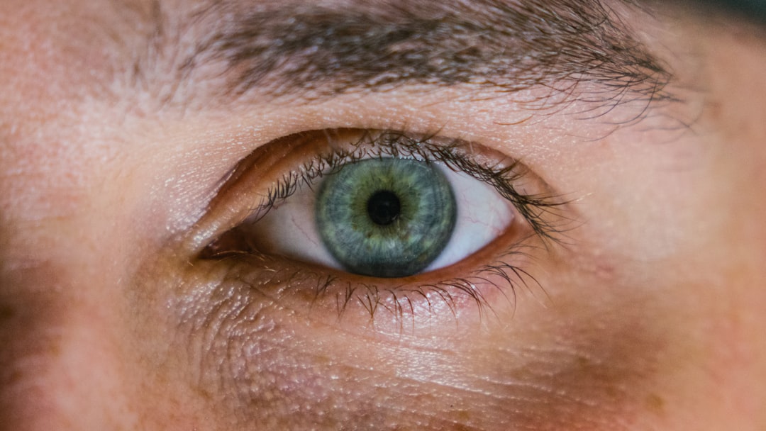 An up close eye showing how to prepare for cataract surgery.